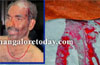 Mangalore : Man grievously attacked near Kulur Junction